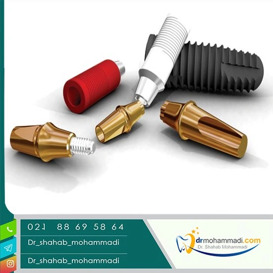  طول عمر ایمپلنت‌ کره‌ای چقدر است؟